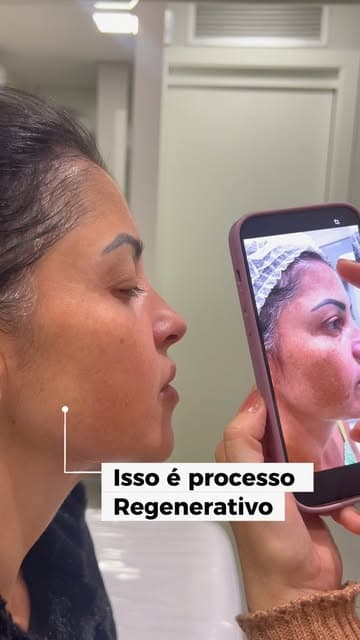 Evolução que merece ser registrada ✨
Antes e depois de um protocolo regenerativo em evolução. Cada etapa respeita o tempo do organismo e mostra que resultados consistentes são construídos com cuidado, acompanhamento e constância. 🌿
Ainda estamos no processo — e a transformação continua! 💫